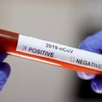 Інформація щодо епідситуації в Україні та Дніпропетровській області на 27.05.2020 року