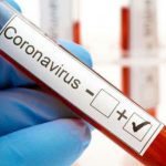 Інформація щодо епідситуації в Україні та Дніпропетровській області на 18.05.2020 року