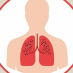 ТУБЕРКУЛЬОЗ . ЗАХОДИ ТА  ПРОФІЛАКТИКА