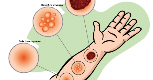 Увага! Важлива інформація!