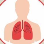 Туберкульоз та заходи подолання